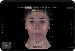 3D facial analysis showing measurement grid and proportion mapping