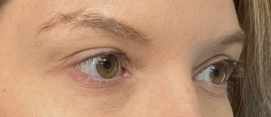 Lashes and Brows before treatment at Juvly Aesthetics