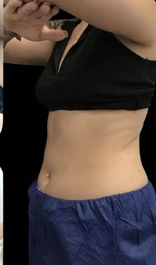 Wellness Rx Membership after treatment at Juvly Aesthetics