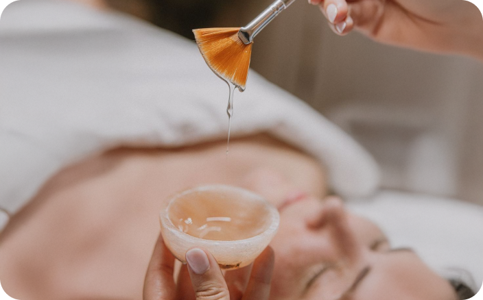Classic Chemical Peel at Juvly Aesthetics