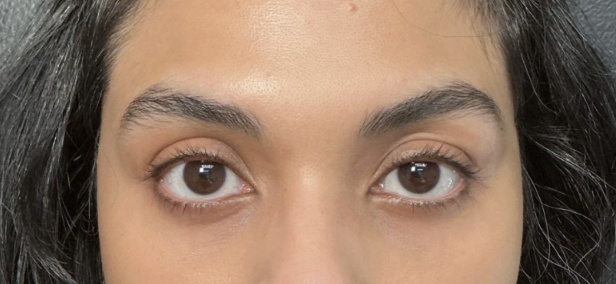 Lashes and Brows before treatment at Juvly Aesthetics