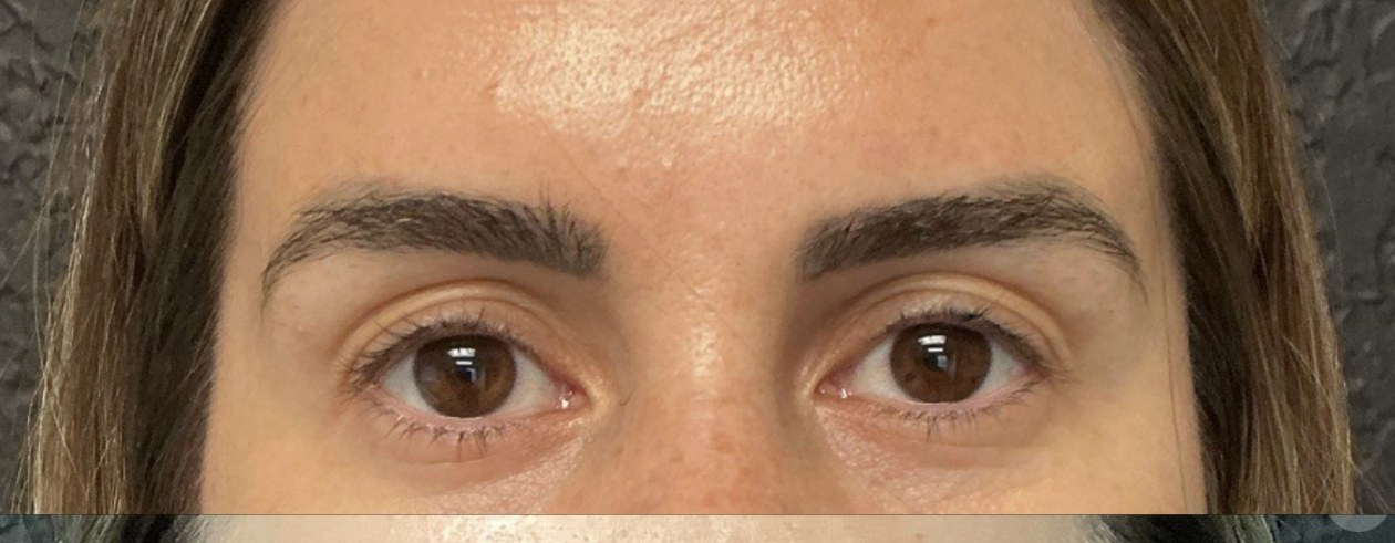 Lashes and Brows before treatment at Juvly Aesthetics