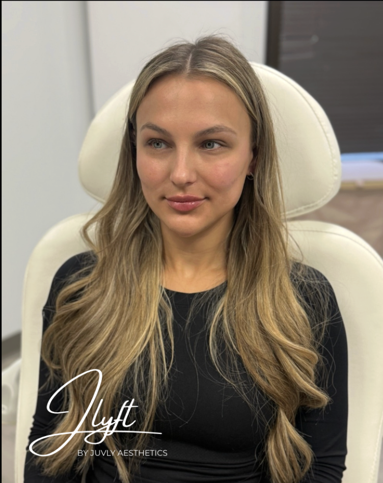 Juvly client in clinic after her JLyft non-surgical facelift