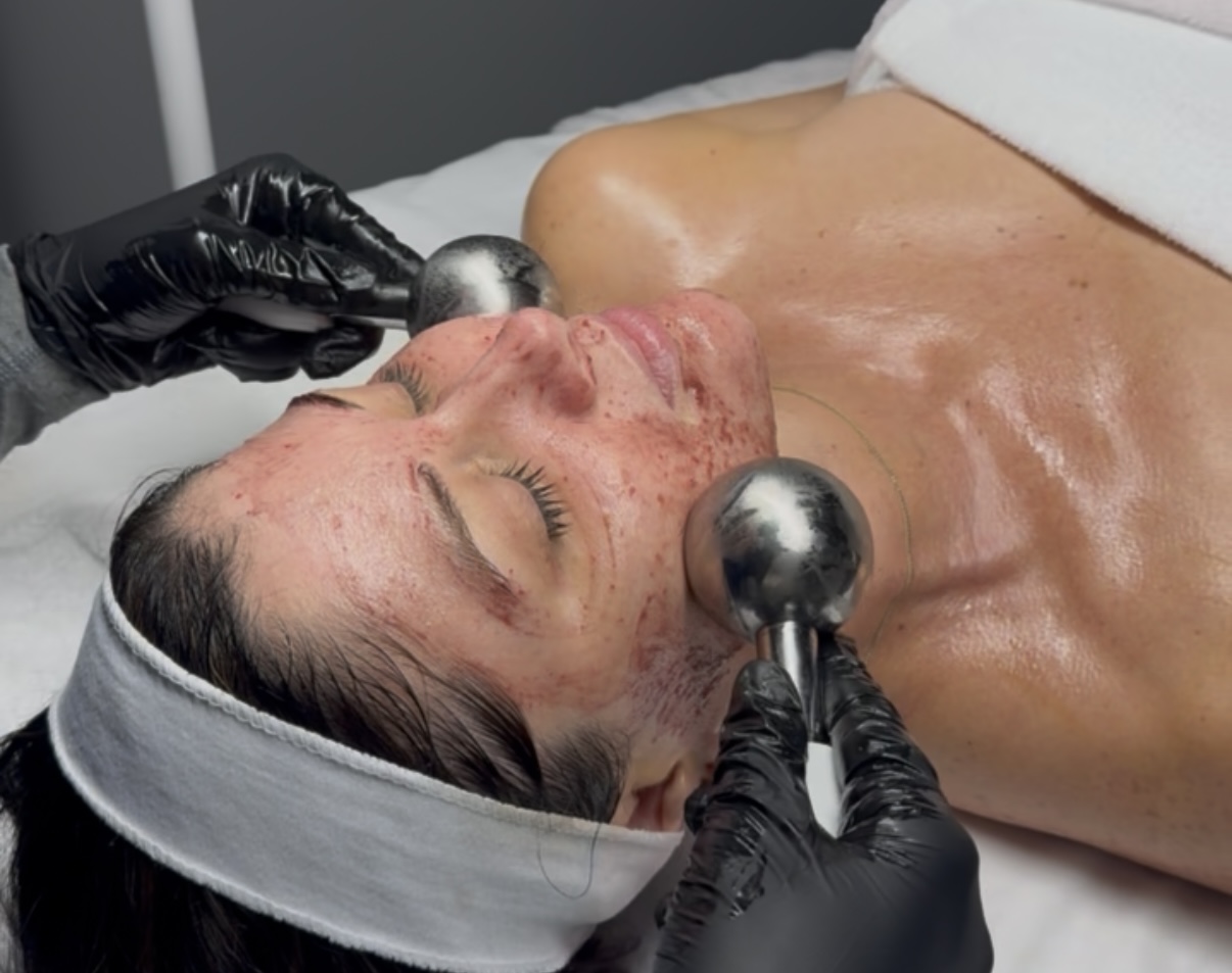 Cryo globe facial treatment at Juvly Aesthetics