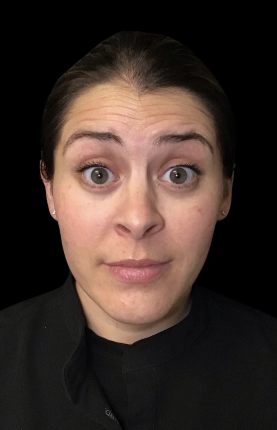 Wrinkle Relaxers before treatment at Juvly Aesthetics
