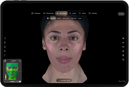 3D facial analysis showing skin condition overlay